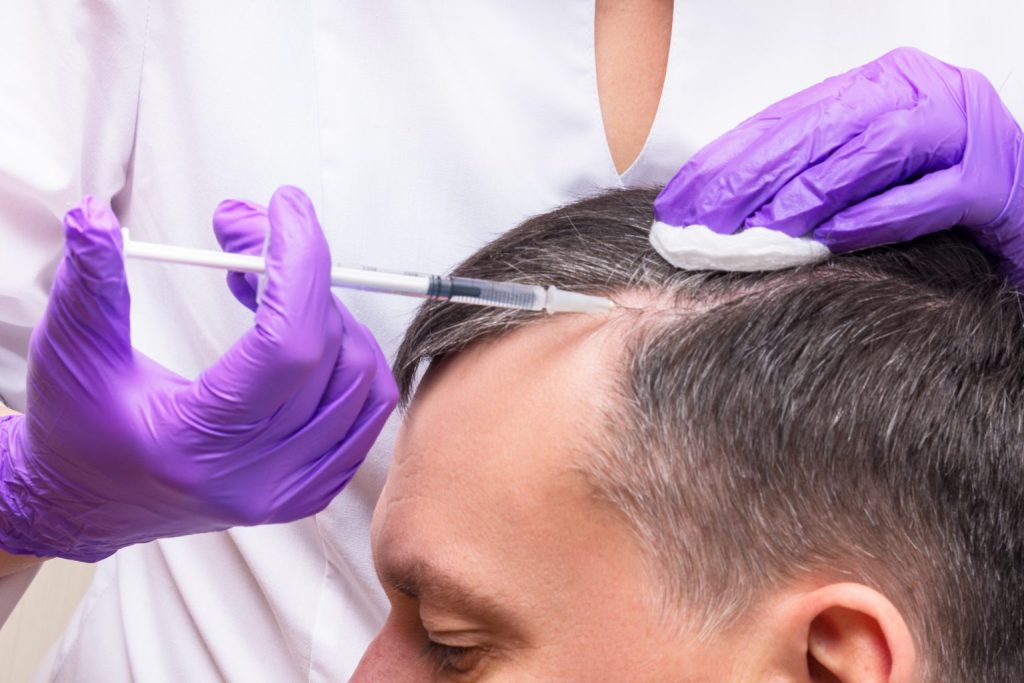 Why Is PRP Treatment a Popular Choice in Cosmetic and Hair Clinics?