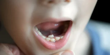 7 Signs Your Child May Need a Baby Tooth Root Canal
