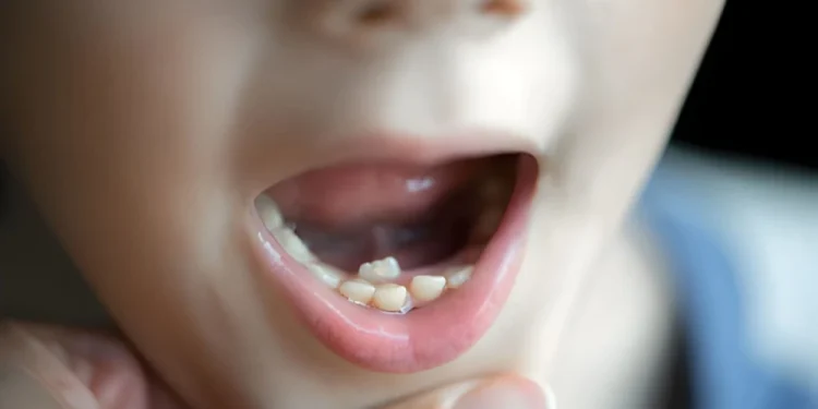 7 Signs Your Child May Need a Baby Tooth Root Canal