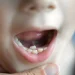 7 Signs Your Child May Need a Baby Tooth Root Canal