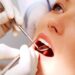 How Dental Clinics Help Maintain Preventive Oral Care