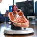TAVI: A Simple Guide for Patients and Families