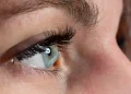 Keratoconus: Why Blurry Vision and Frequent Prescription Changes Need Attention