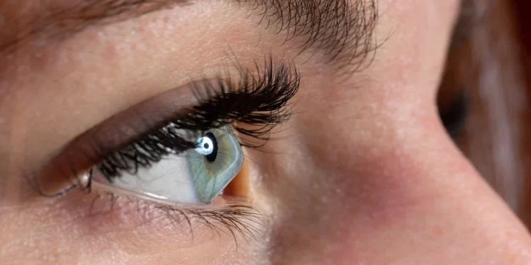 Keratoconus: Why Blurry Vision and Frequent Prescription Changes Need Attention