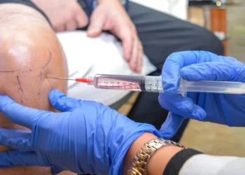 Why More Patients Are Exploring Stem Cell Treatments for Rheumatoid Arthritis?