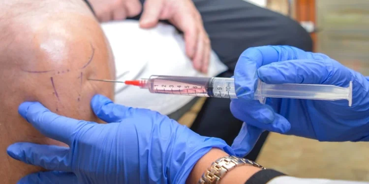 Why More Patients Are Exploring Stem Cell Treatments for Rheumatoid Arthritis?