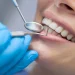 How General Dentistry Personalizes Preventive Plans For Every Patient