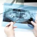 The Step-by-Step Plan to a Comfortable Surgical Wisdom Tooth Extraction